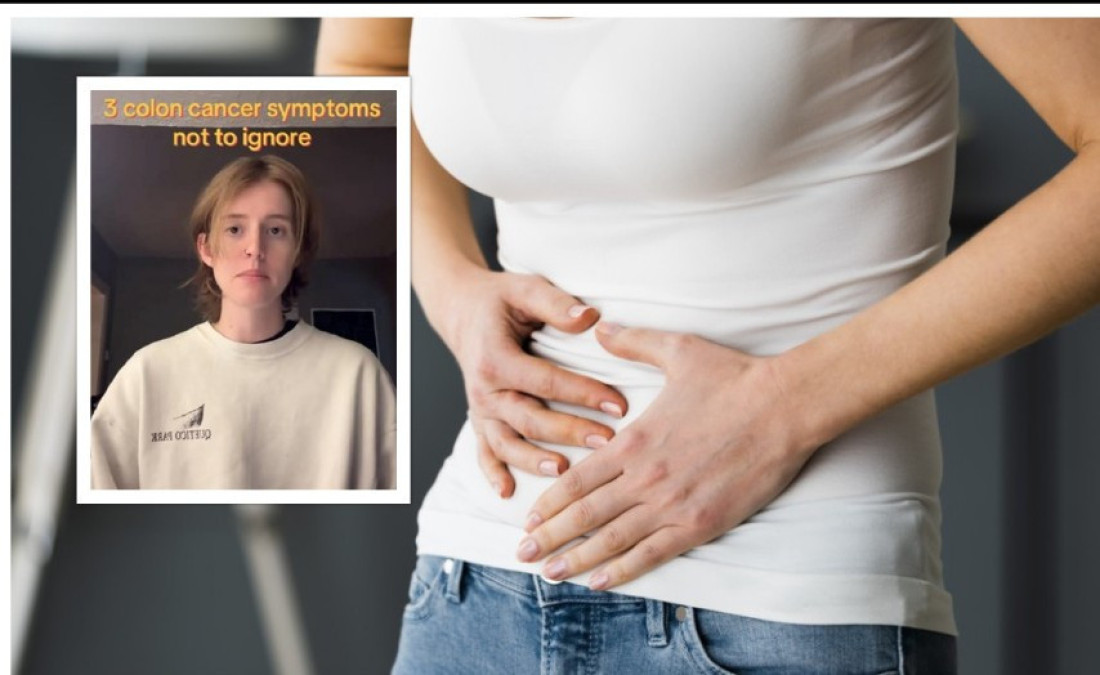 Tri simptoma raka debelog creva Pejdž Sejfert