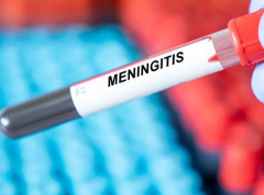 Upola manje smrtnih slučajeva od meningitisa širom sveta od 1990.