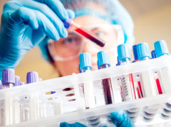 Novi tretman uništava 99 odsto ćelija raka u laboratorijskim testovima