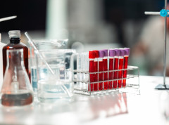 Naučnici razvili lek protiv HIV-a na bazi retkih zemnih katjona